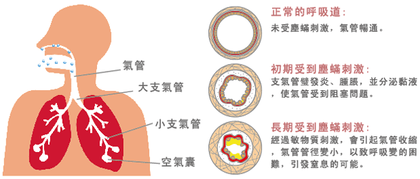 氣喘用藥之外 掌握四大原則 控制氣喘方法