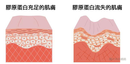 膠原蛋白 想擁美麗,就千萬別失膠